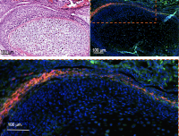 Stem cells used in Morse's research on TMJ regeneration.